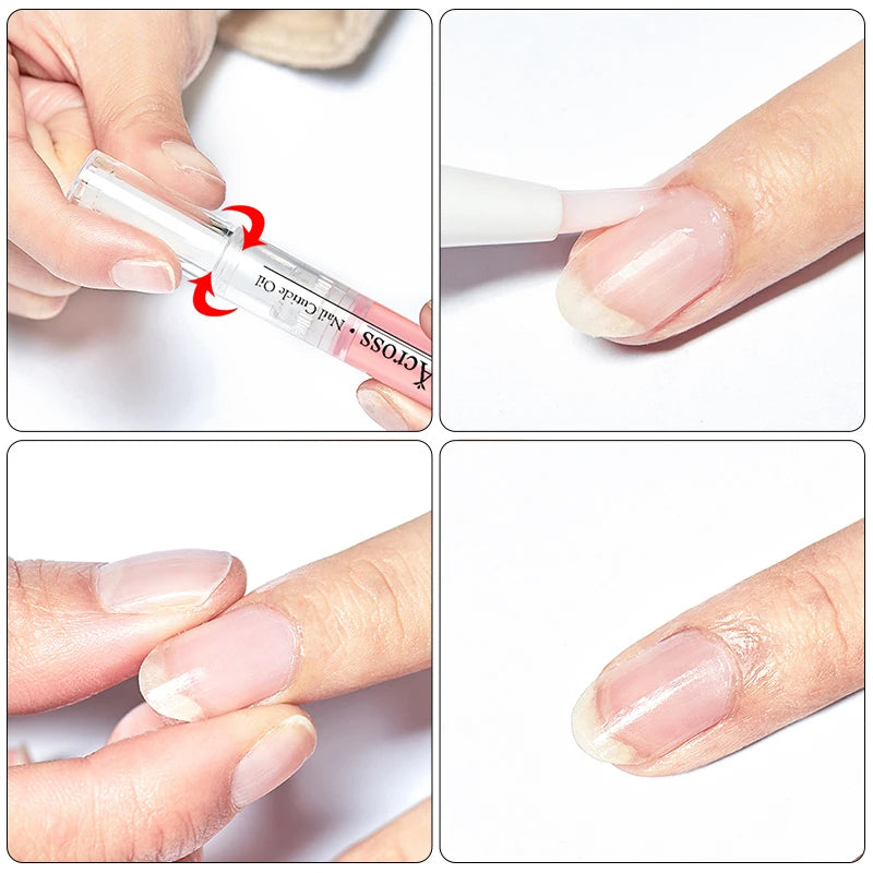 5ml nail and cuticle oil pen for nourishment and hydration, designed to treat dry nails and cuticles, promoting healthy, strong nails and soft skin